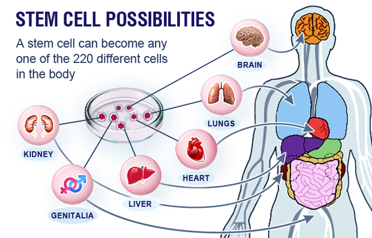 Stem Cell Treatment for Autism